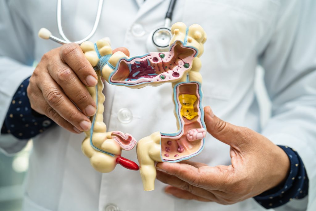 Maquette détaillée d'un système digestif humain tenue par un médecin, spécialiste des troubles digestifs en Bourgoin